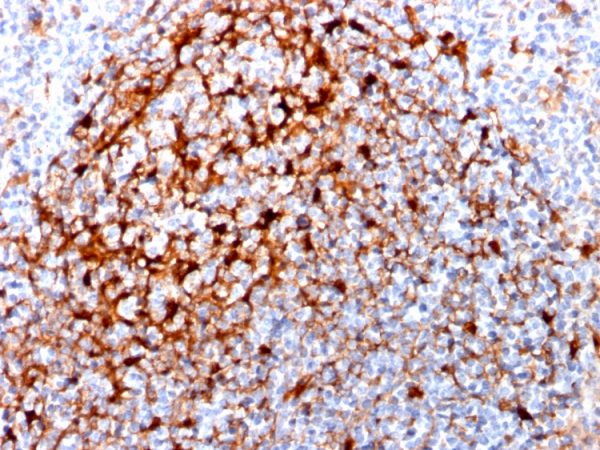 Formalin-fixed, paraffin-embedded human Tonsil stained with Cystatin A Mouse Monoclonal Antibody (CPTC-CSTA-1).
