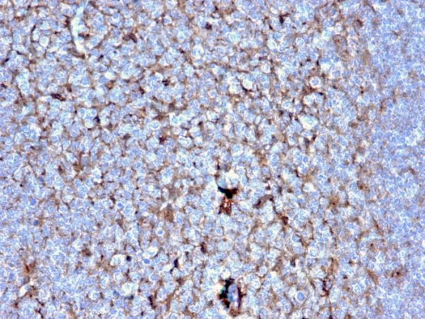Formalin-fixed, paraffin-embedded human Tonsil stained with Cystatin A Mouse Monoclonal Antibody (CSTA/2882).