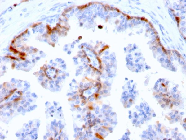 Formalin-fixed, paraffin-embedded human Prostate stained with Cystatin A Mouse Monoclonal Antibody (CSTA/2882).