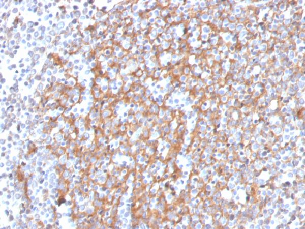Formalin-fixed, paraffin-embedded human Prostate stained with Cystatin A Mouse Monoclonal Antibody (CSTA/3553).