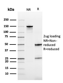 SDS-PAGE Analysis Purified Cystatin B Mouse Monoclonal Antibody (CPTC-CSTB-3). Confirmation of Purity and Integrity of Antibody.