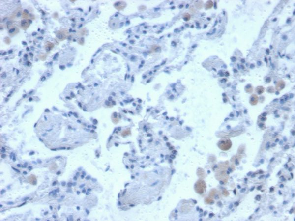 Formalin-fixed, paraffin-embedded human lung stained with Cystatin B Mouse Monoclonal Antibody (CPTC-CSTB-3).