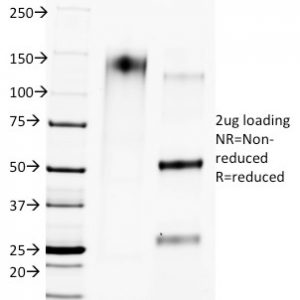 SDS-PAGE Analysis of Purified CTLA4 Mouse Monoclonal Antibody (L4P2F5.F10). Confirmation of Purity and Integrity of Antibody.