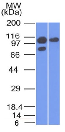 Western Blot of A431 and MCF-7 cell lysate using Catenin, alpha-1 Mouse Monoclonal Antibody (1G5).