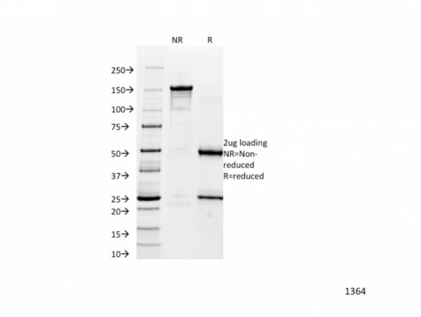 SDS-PAGE Analysis Purified Catenin, alpha-1 Mouse Monoclonal Antibody (1G5).