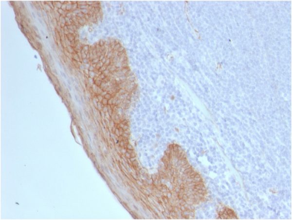 Formalin-fixed, paraffin-embedded human Tonsil stained with Catenin beta Mouse Monoclonal Antibody (CTNNB1/2098).