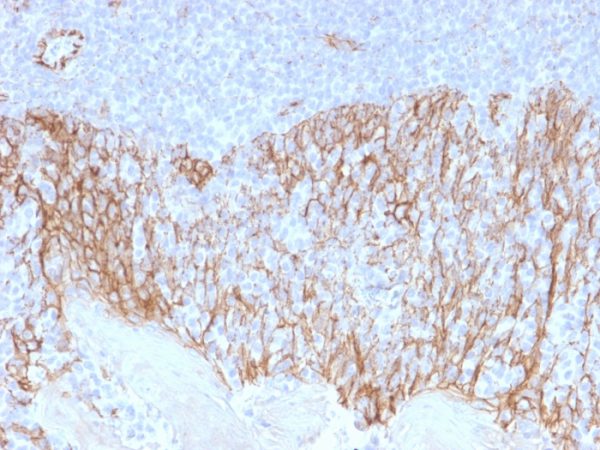 Formalin-fixed, paraffin-embedded human Tonsil stained with Beta-Catenin Mouse Monoclonal Antibody (CTNNB1/2099).