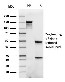 SDS-PAGE Analysis of Purified p120 Recombinant Mouse Monoclonal Antibody (rCTNNB1/1507). Confirmation of Purity and Integrity of Antibody.