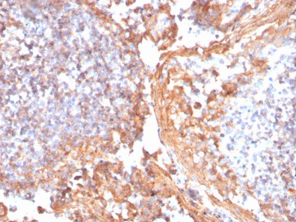 Formalin-fixed, paraffin-embedded human tonsil stained with Catenin, beta Recombinant Mouse Monoclonal Antibody (rCTNNB1/1507).
