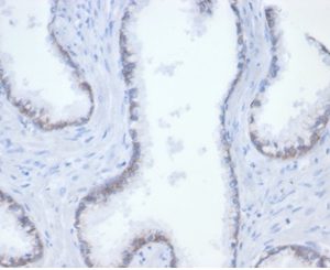 Formalin-fixed, paraffin-embedded human tonsil stained with Catenin beta Recombinant Mouse Monoclonal Antibody (rCTNNB1/7358). HIER: Tris/EDTA, pH9.0, 45min. 2 °: HRP-polymer, 30min. DAB, 5min.