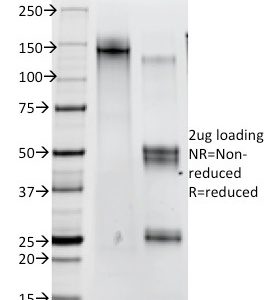 SDS-PAGE Analysis of Purified Catenin, beta Mouse Monoclonal Antibody (12F7). Confirmation of Purity and Integrity of Antibody.