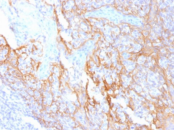 Formalin-fixed, paraffin-embedded human Tonsil stained with Beta-Catenin Mouse Monoclonal Antibody (15B8).