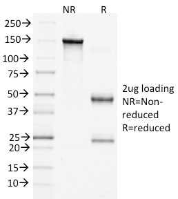 SDS-PAGE Analysis of Purified Beta-Catenin Mouse Monoclonal Antibody (15B8). Confirmation of Purity and Integrity of Antibody