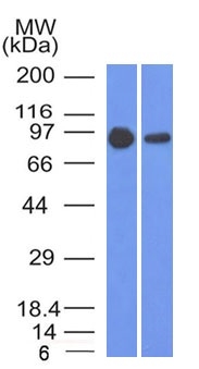 Western Blot of A431 and A549 cell lysates using Catenin, beta Mouse Monoclonal Antibody (5H10)