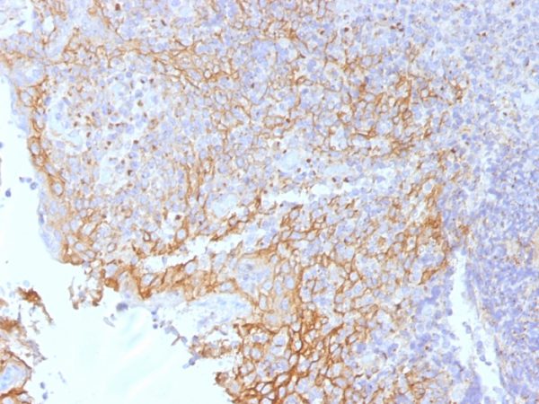 Formalin-fixed, paraffin-embedded human Tonsil stained with Beta-Catenin (p120) Monoclonal Antibody (5H10).