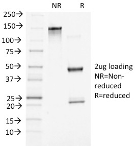 SDS-PAGE Analysis of Purified Beta-Catenin (p120) Monoclonal Antibody (5H10). Confirmation of Purity and Integrity of Antibody.