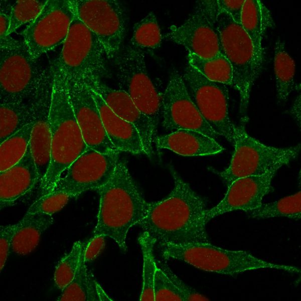 Confocal immunofluorescence image of HeLa cells using Beta-Catenin (p120) Monoclonal Antibody (6F9). Green (CF488) and Reddot is used to label the nuclei.