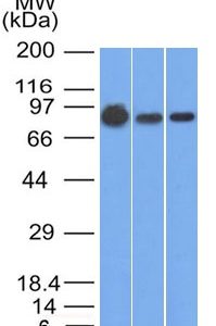 Western Blot of A431, A549 and MCF-7 cell lysates using Catenin, beta Mouse Monoclonal Antibody (9F2)