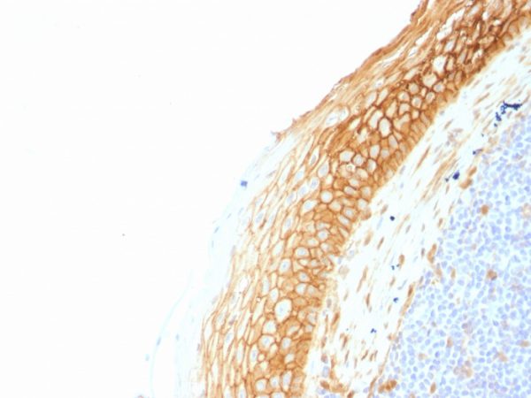 Formalin-fixed, paraffin-embedded human Tonsil stained with Beta-Catenin (p120) Monoclonal Antibody (CTNNB1/1507).