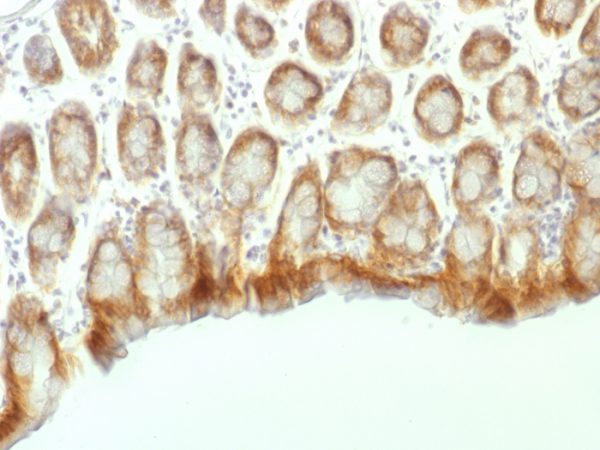 Formalin-fixed, paraffin-embedded Mouse Colon stained with Beta-Catenin (p120) Monoclonal Antibody (CTNNB1/1507).