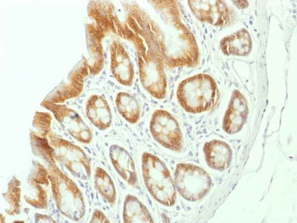 Formalin-fixed, paraffin-embedded Rat Colon stained with Beta-Catenin (p120) Monoclonal Antibody (CTNNB1/1507).