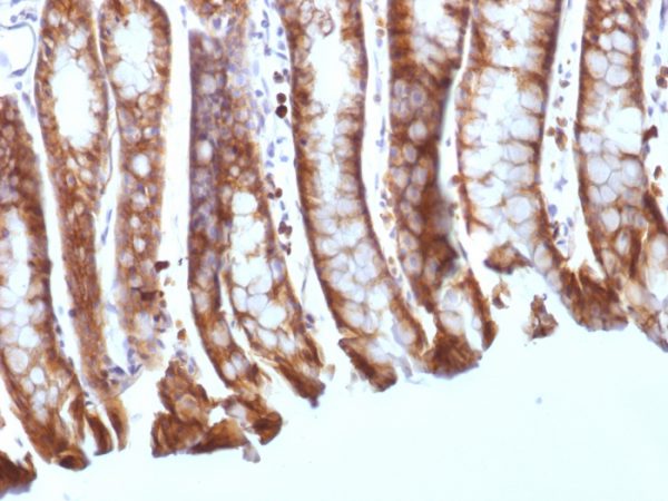 Formalin-fixed, paraffin-embedded Mouse Colon stained with Beta-Catenin (p120) Monoclonal Antibody (CTNNB1/1508).