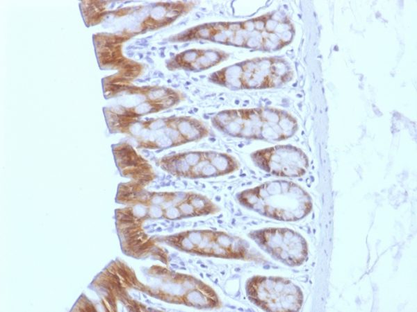 Formalin-fixed, paraffin-embedded Rat Colon stained with Beta-Catenin (p120) Monoclonal Antibody (CTNNB1/1508).