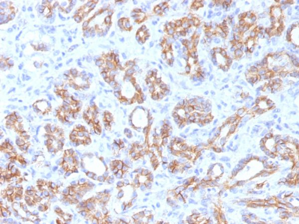 Formalin-fixed, paraffin-embedded human Pancreas stained with Beta-Catenin (p120) Monoclonal Antibody (CTNNB1/1509).