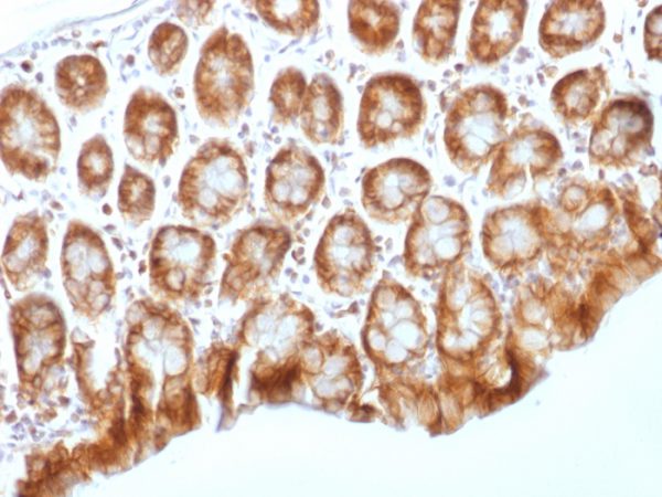 Formalin-fixed, paraffin-embedded Mouse Colon stained with Beta-Catenin (p120) Monoclonal Antibody (CTNNB1/1509).