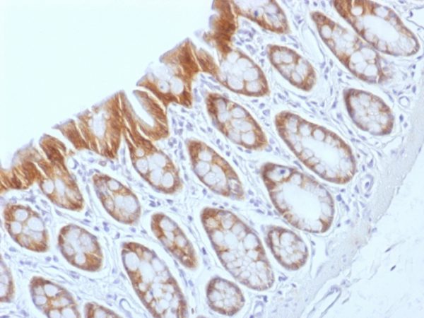 Formalin-fixed, paraffin-embedded Rat Colon stained with Beta-Catenin (p120) Monoclonal Antibody (CTNNB1/1509).
