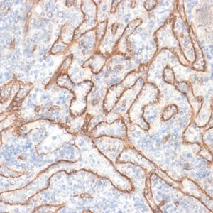 Formalin-fixed, paraffin-embedded human tonsil stained with Beta-Catenin Recombinant Rabbit Monoclonal Antibody (CTNNB1/2030R).