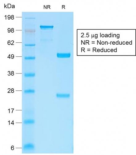 SDS-PAGE Analysis Purified Beta-Catenin Recombinant Rabbit Monoclonal Ab (CTNNB1/2030R). Confirmation of Purity and Integrity of Antibody.