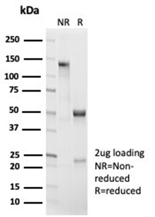SDS-PAGE Analysis  Purified Beta-Catenin Recombinant Rabbit Monoclonal (CTNNB1/7044R). Confirmation of Purity and Integrity of Antibody.