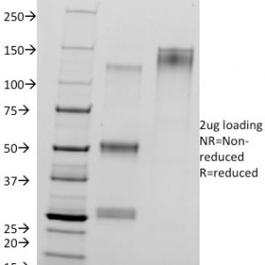 SDS-PAGE Analysis of Purified CTNND1 Mouse Monoclonal Antibody (25a). Confirmation of Purity and Integrity of Antibody.