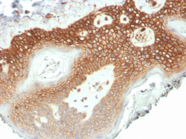 IHC analysis of formalin-fixed, paraffin-embedded human colon. CTNND1/4501 at 2ug/ml in PBS for 30min RT. HIER: Tris/EDTA, pH9.0, 45min. 2°C: HRP-polymer, 30min. DAB, 5min.