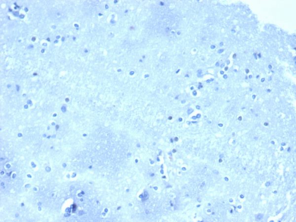 Negative tissue control. IHC analysis of formalin-fixed, paraffin-embedded human brain stained with CTNND1/4501 at 2ug/ml in PBS for 30min RT. HIER: Tris/EDTA, pH9.0, 45min. 2°C: HRP-polymer, 30min. DAB, 5min.