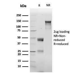 SDS-PAGE Analysis of Purified p120 Recombinant Mouse Monoclonal Antibody (rCTNND1/6903). Confirmation of Integrity and Purity of Antibody.