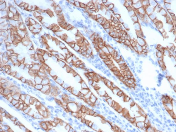 IHC analysis of formalin-fixed, paraffin-embedded human stomach. Glandular cells stained using rCTNND1/6903 at 2ug/ml in PBS for 30min RT. HIER: Tris/EDTA, pH9.0, 45min. 2°C: HRP-polymer, 30min. DAB, 5min.