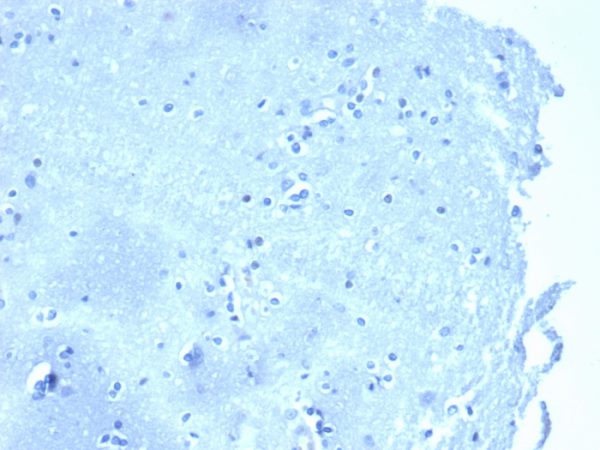 Negative tissue control. IHC analysis of formalin-fixed, paraffin-embedded human brain stained with CTNND1/4383R at 2ug/ml in PBS for 30min RT. HIER: Tris/EDTA, pH9.0, 45min. 2°C: HRP-polymer, 30min. DAB, 5min.