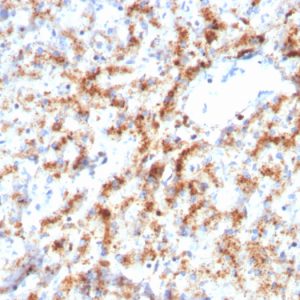 Formalin-fixed, paraffin-embedded human liver stained with Cathepsin D Mouse Monoclonal Antibody (CTSD/3082).