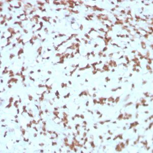 Formalin-fixed, paraffin-embedded human Liver stained with Cathepsin D Mouse Monoclonal Antibody (CTSD/3275).