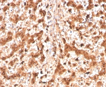 Formalin-fixed, paraffin-embedded human liver stained with Cathepsin D Mouse Monoclonal Antibody (CTSD/4497).