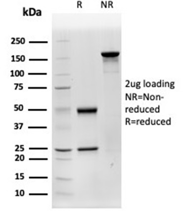 SDS-PAGE Analysis Purified Cathepsin D Mouse Monoclonal Antibody (CTSD/4497). Confirmation of Purity and Integrity of Antibody.