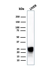 Western blot analysis of human livertissue lysate using Cathepsin D Mouse Monoclonal Antibody (CTSD/4497).