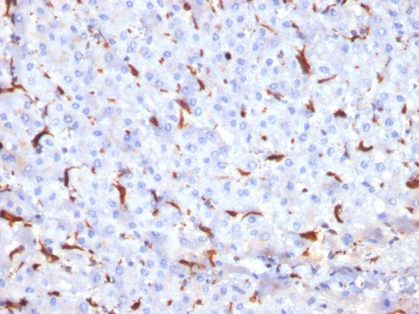 Formalin-fixed, paraffin-embedded human Liver stained with Cathepsin K Mouse Monoclonal Antibody (CTSK/2791).