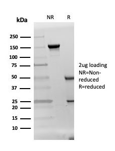 SDS-PAGE Analysis of Purified DAZL Mouse Monoclonal Antibody (DAZL/4253) Confirmation of Integrity and Purity of Antibody.