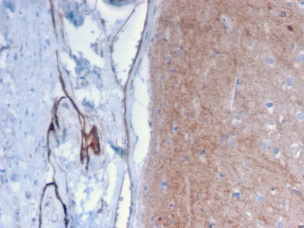 Formalin-fixed, paraffin-embedded human Brain stained with Drebrin-1 Mouse Monoclonal Antibody (DBN1/2879).