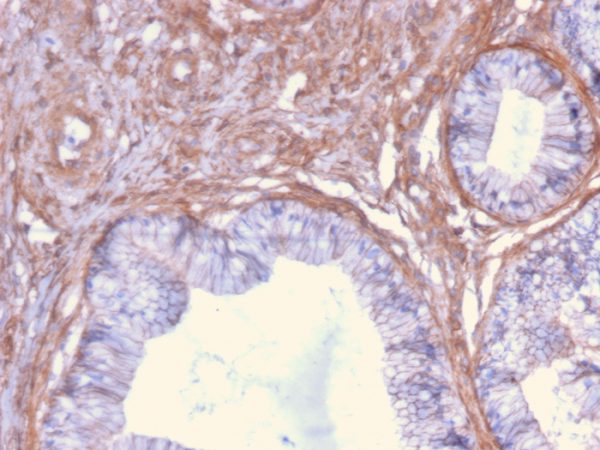 Formalin-fixed, paraffin-embedded human Cervix stained with Drebrin-1 Mouse Monoclonal Antibody (DBN1/2879).
