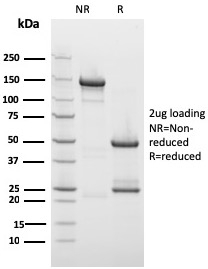 SDS-PAGE Analysis of Purified Drebrin-1 Mouse Monoclonal Antibody (DBN1/2879). Confirmation of Integrity and Purity of Antibody.