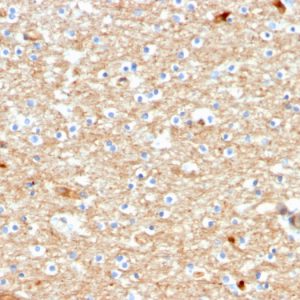 Formalin-fixed, paraffin-embedded human Brain stained with Drebrin-1 Mouse Monoclonal Antibody (DBN1/2880).